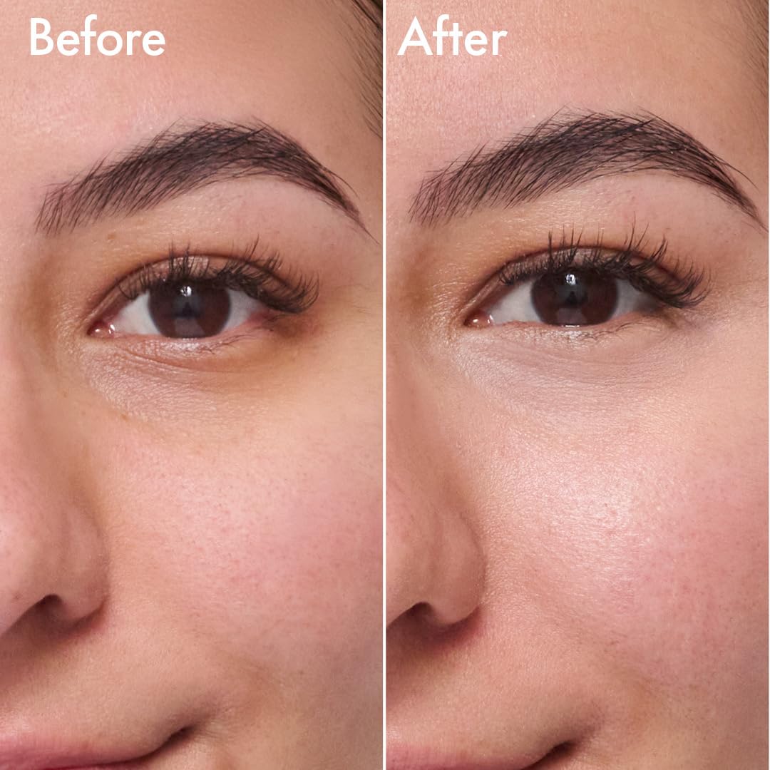 Catrice Under Eye Brightener – Dark Circles Color Corrector | Hyaluronic Acid & Shea Butter (5 Shades)