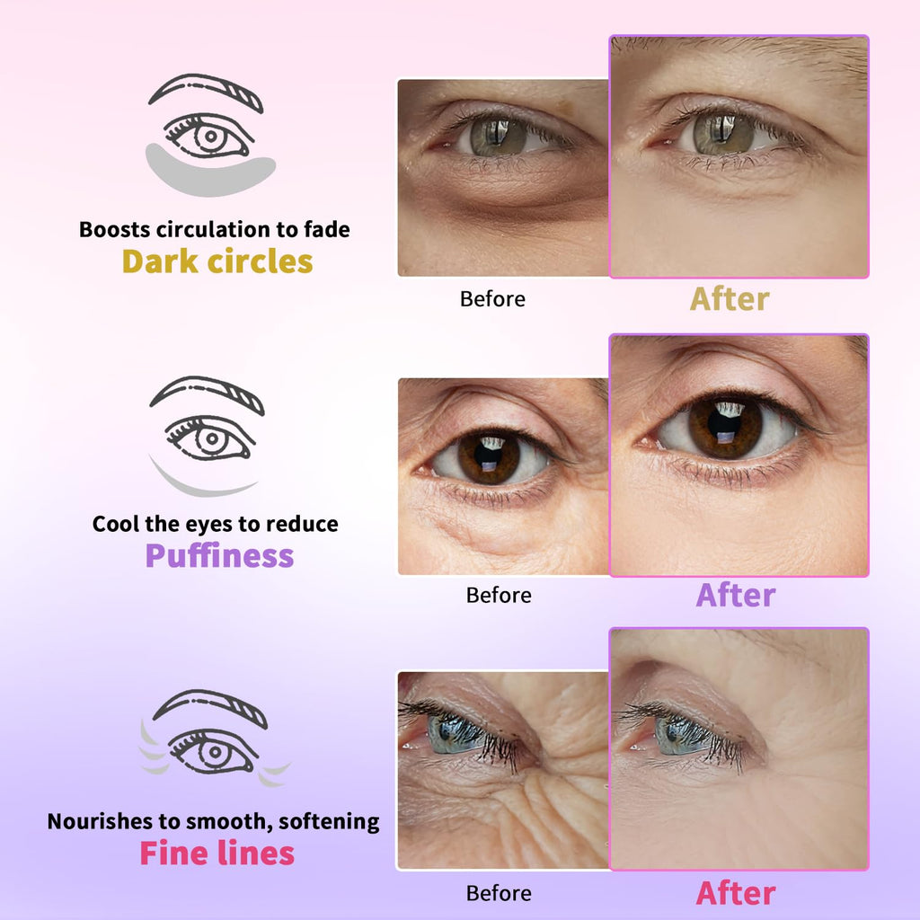 AILEORY Under Eye Patches – Tri-Color Glitter Gel Pads | Dark Circles, Puffiness & Wrinkles