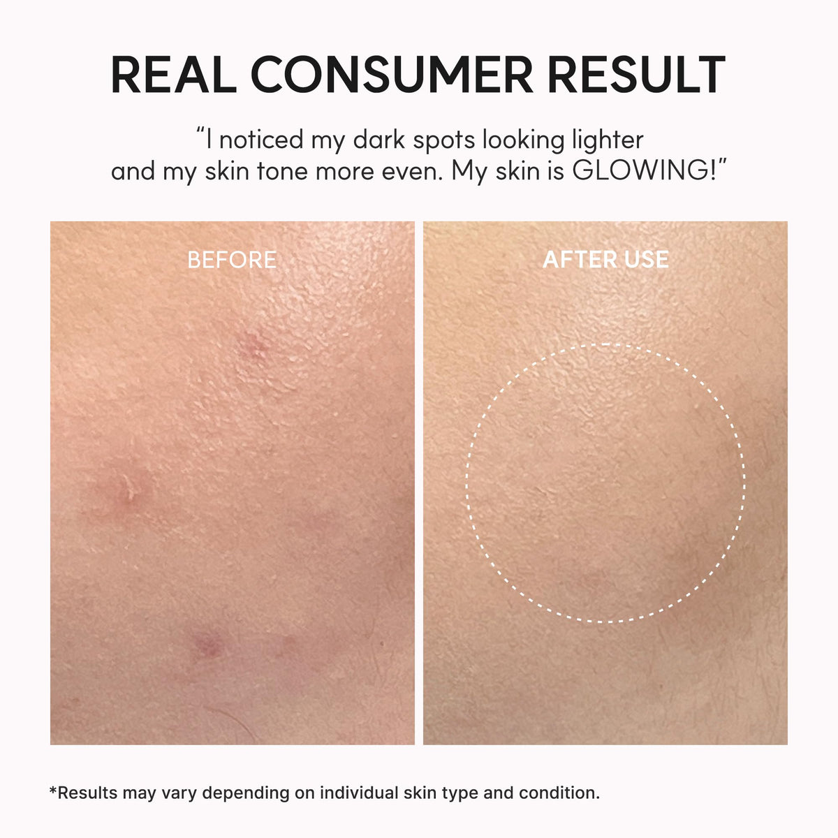 Arencia Vitamin C Booster Shot Serum with Glutathione, Niacinamide and Vitamin E for Dark Spot Care, Fine Lines & Wrinkles, Glass Skin, Korean Skincare 30ml/1.01 fl.oz