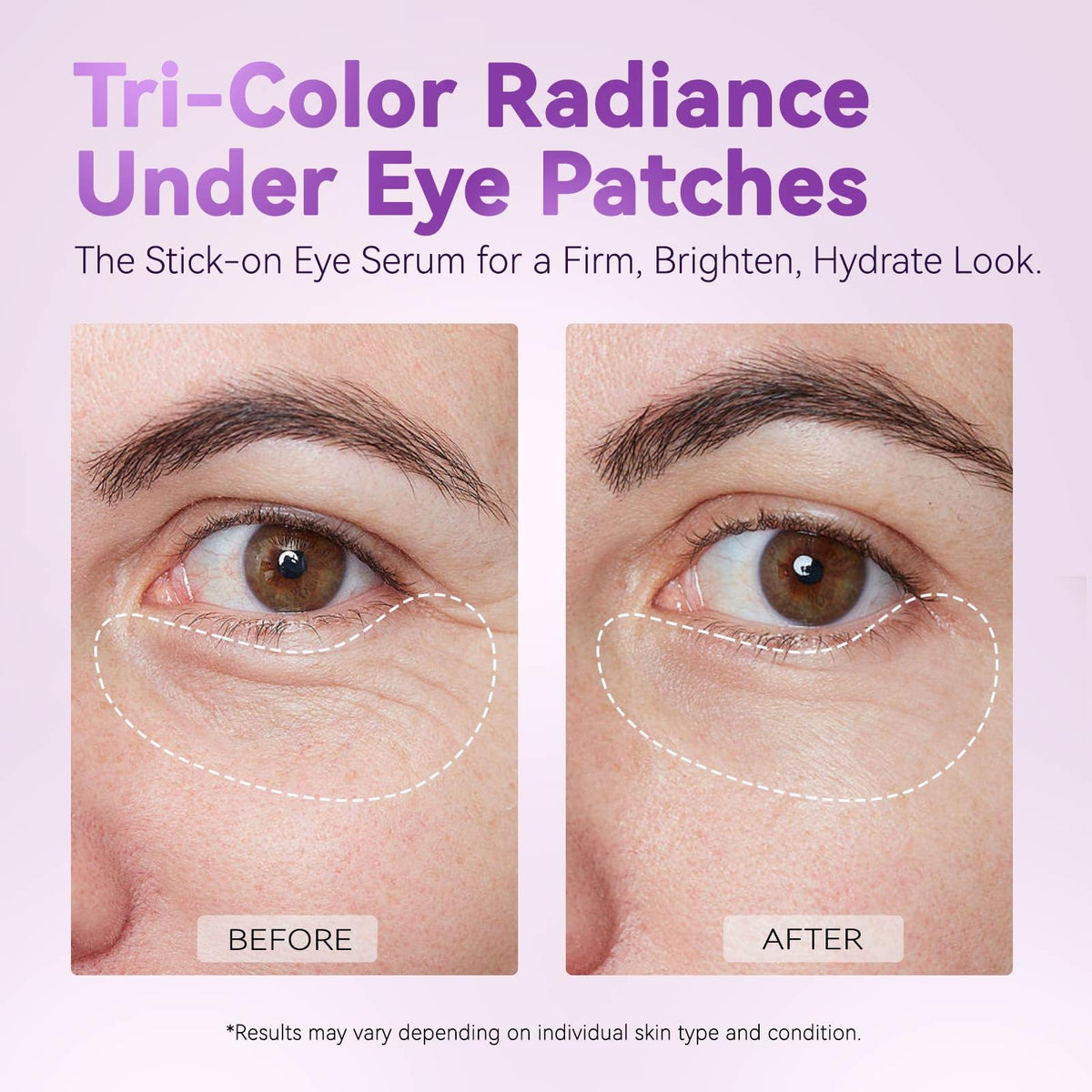 AILEORY Under Eye Patches – Tri-Color Glitter Gel Pads | Dark Circles, Puffiness & Wrinkles