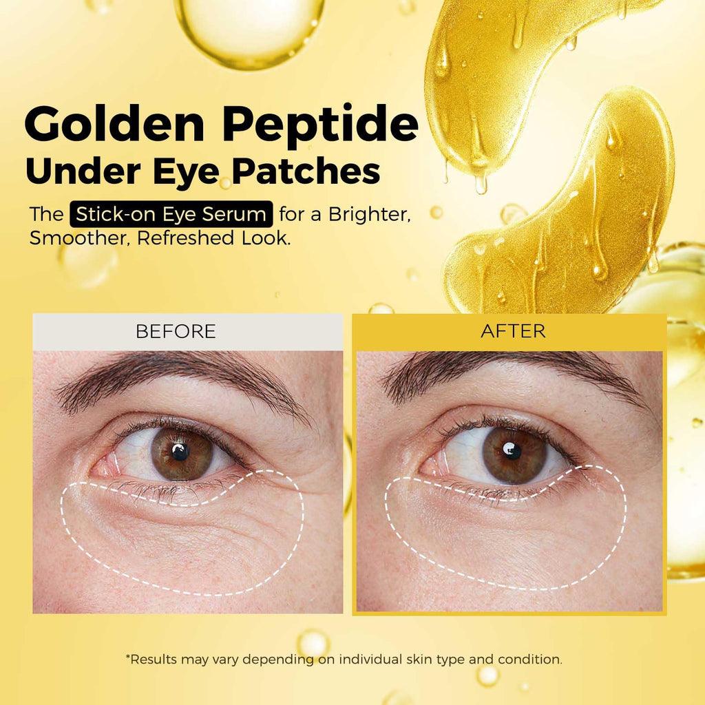 AILEORY Under Eye Patches – Tri-Color Glitter Gel Pads | Dark Circles, Puffiness & Wrinkles