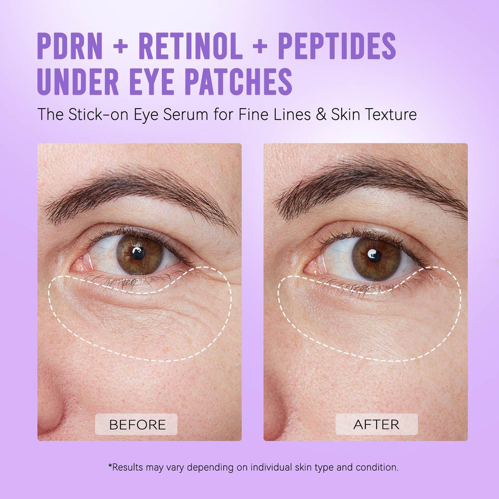 AILEORY Under Eye Patches – Tri-Color Glitter Gel Pads | Dark Circles, Puffiness & Wrinkles