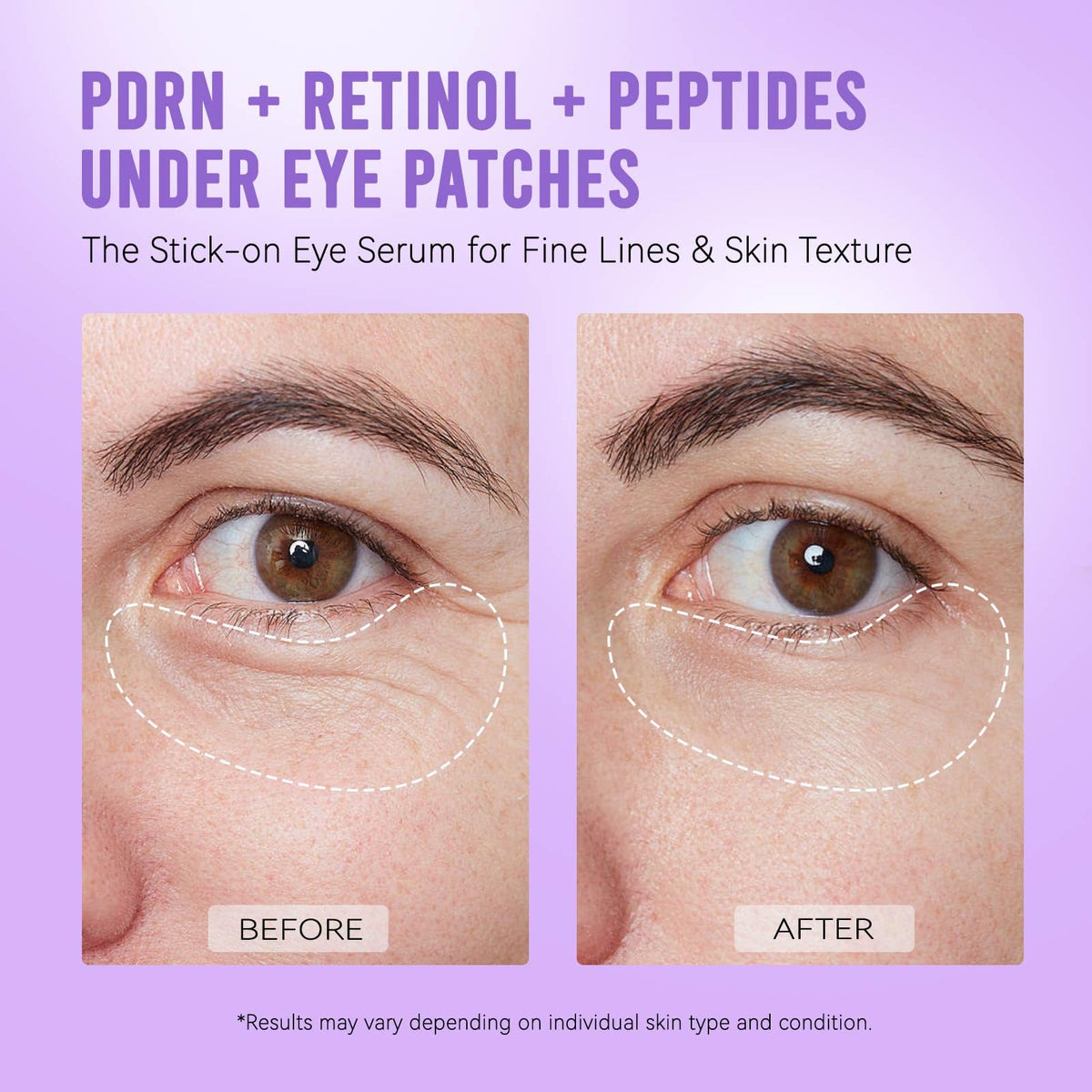 AILEORY Under Eye Patches – Tri-Color Glitter Gel Pads | Dark Circles, Puffiness & Wrinkles