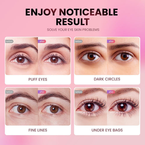 AILEORY Under Eye Patches