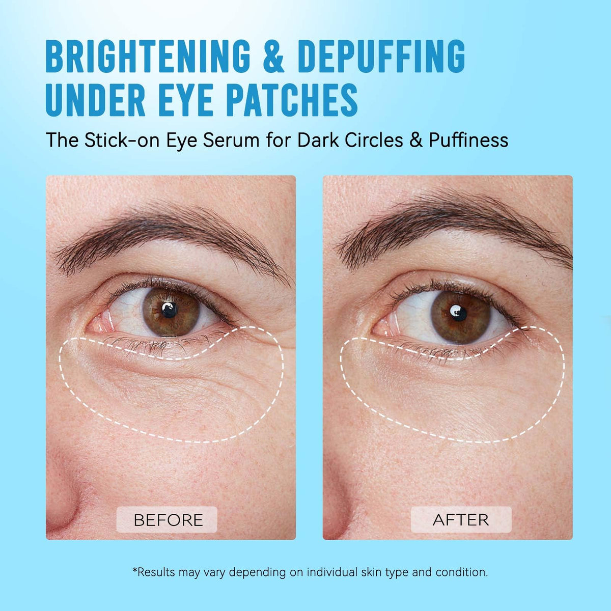 AILEORY Under Eye Patches – Tri-Color Glitter Gel Pads | Dark Circles, Puffiness & Wrinkles