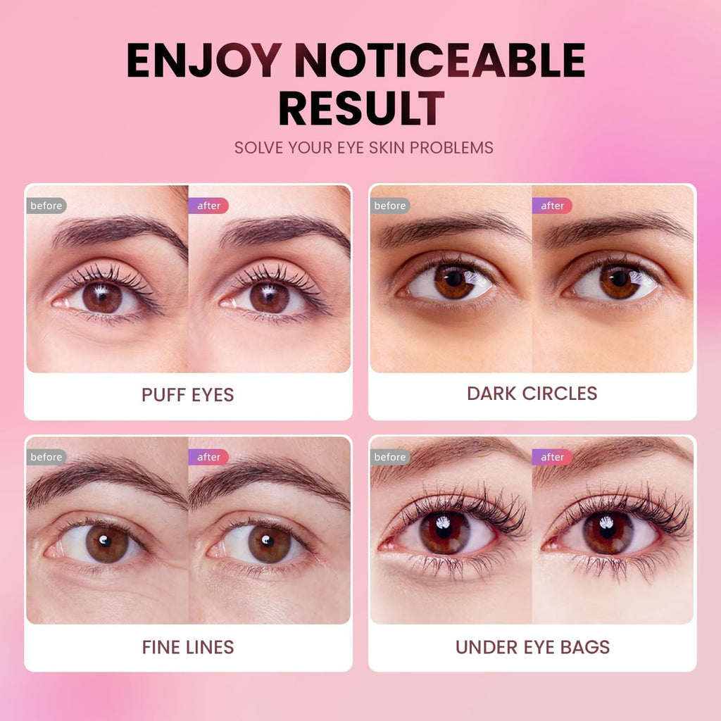 AILEORY Under Eye Patches – Tri-Color Glitter Gel Pads | Dark Circles, Puffiness & Wrinkles