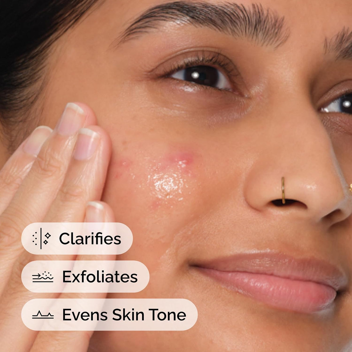 The Ordinary Salicylic Acid 2% Anhydrous Solution – Exfoliating Serum for Clearer Skin